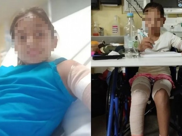 Una mujer denunció que un nene de 11 años prendió fuego a su hija por “celos”